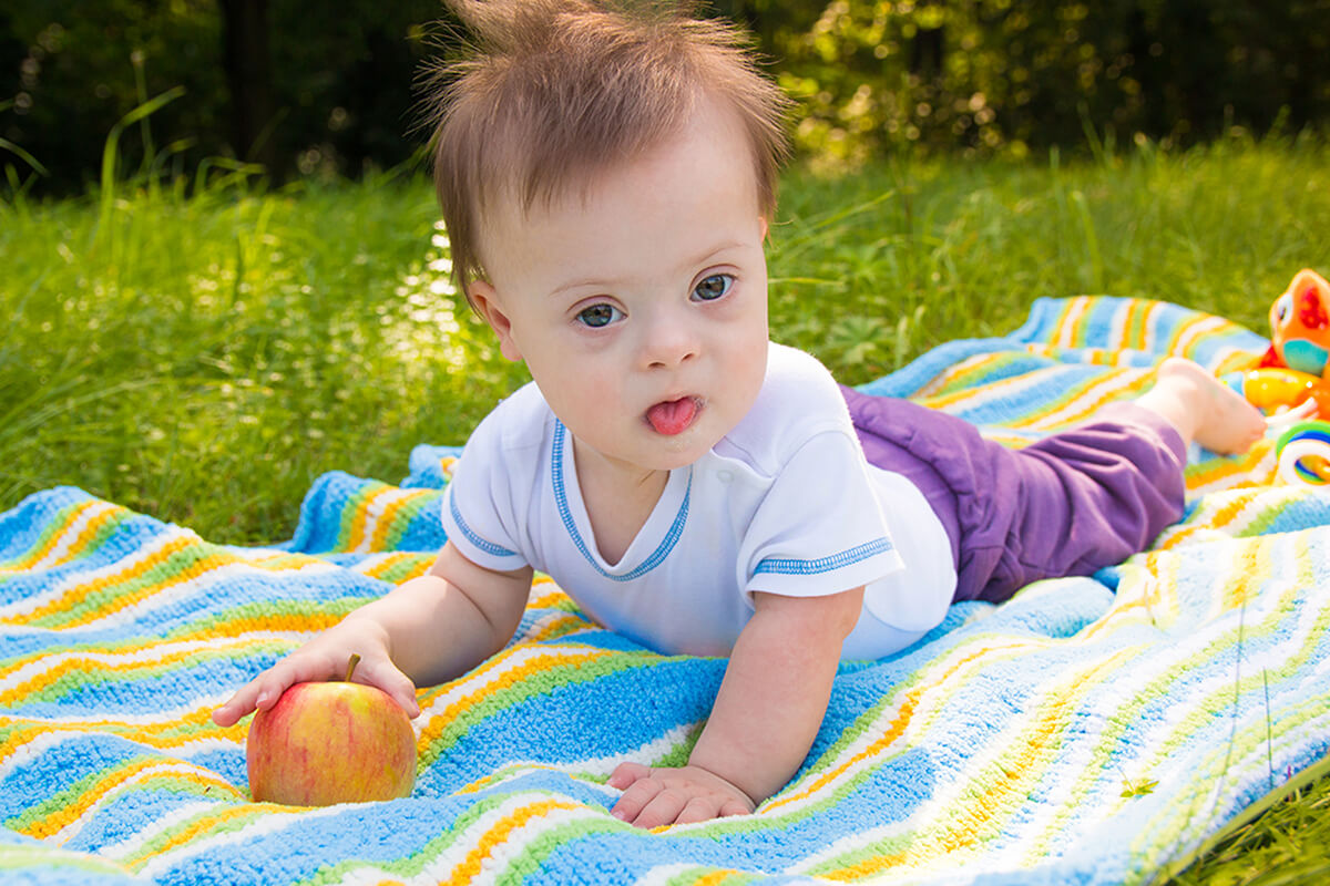 Como saber se o bebê tem síndrome de Down 