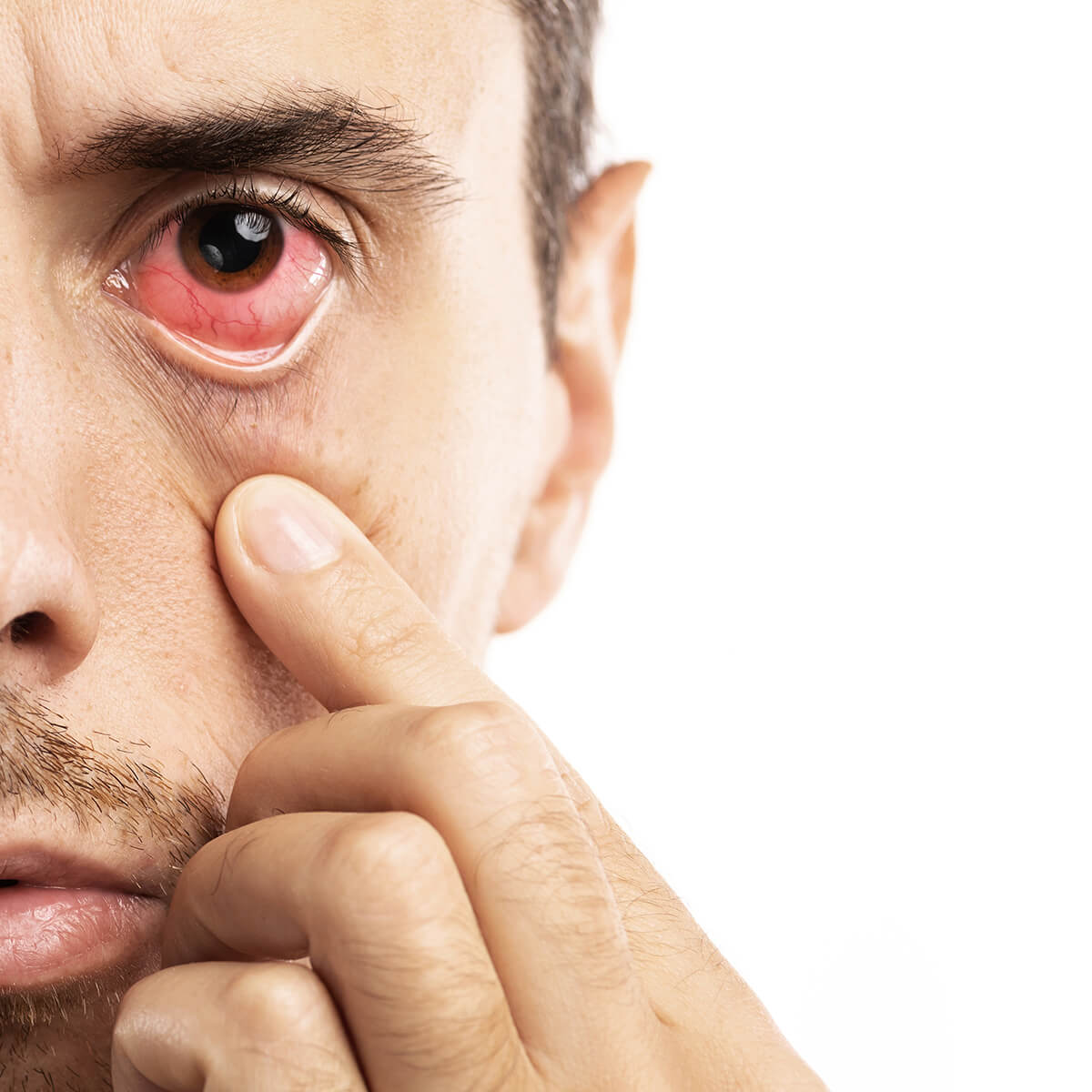 Sintomas de Espasmos no Olho